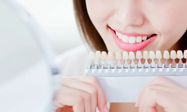 ホワイトニング