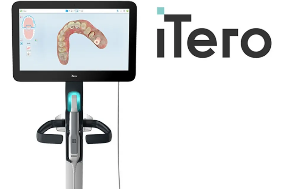 口腔内スキャナー「iTero」