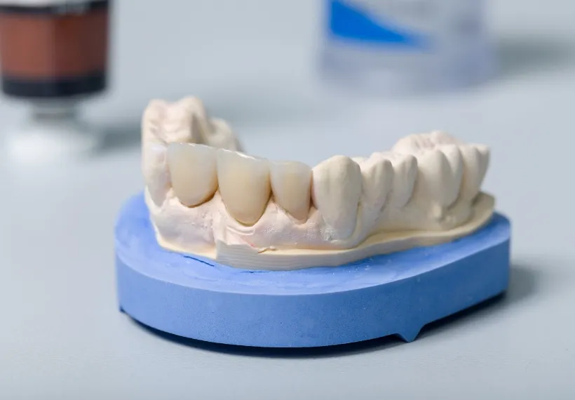人工歯の作製