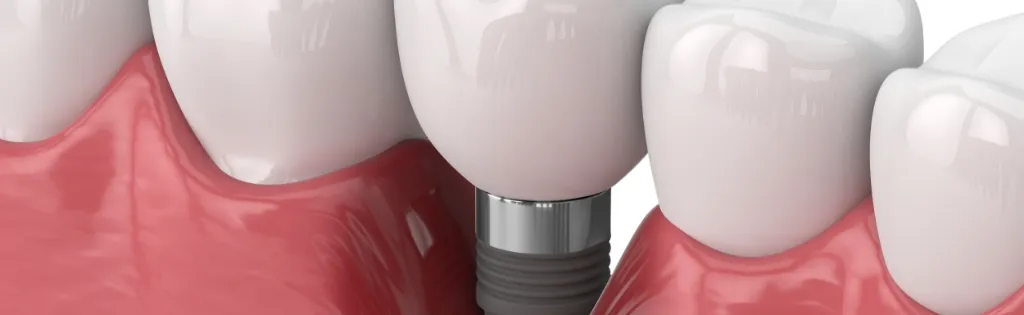 治療後のメンテナンス