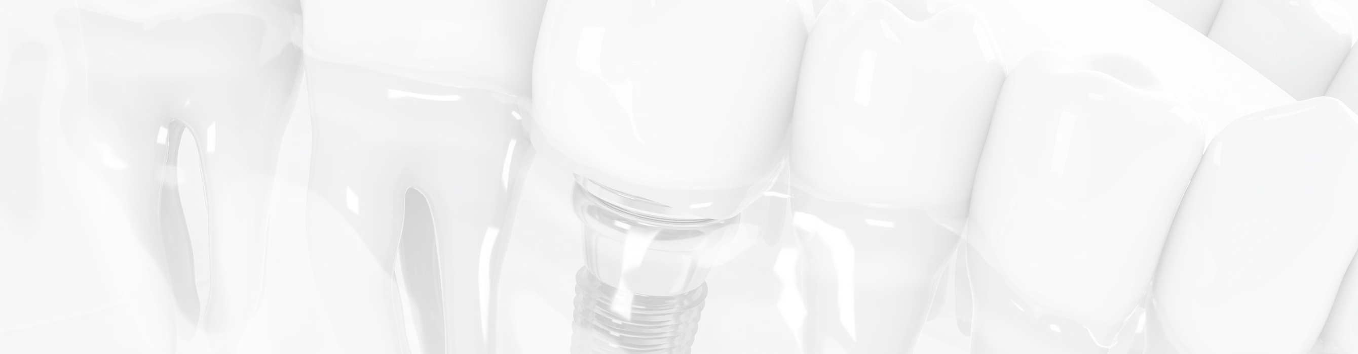 インプラント治療